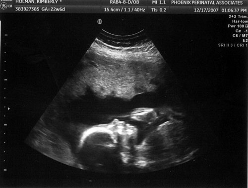 2nd-baby-scan01.jpg