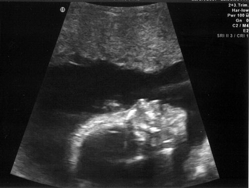 2nd-baby-scan02.jpg